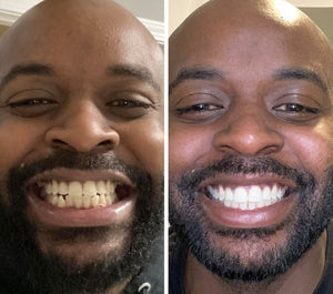 18 Transformations dentaires hallucinantes prouvent qu’il ne faut jamais baisser les bras.jpg